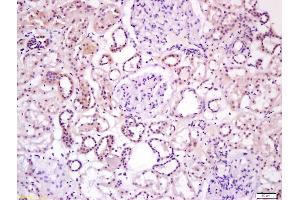 Formalin-fixed and paraffin embedded human kidney labeled with Anti-Wnt16 Polyclonal Antibody, Unconjugated (ABIN1387899) at 1:200 followed by conjugation to the secondary antibody and DAB staining (WNT16 anticorps  (AA 220-265))
