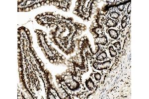 IHC analysis of DDX5 using anti-DDX5 antibody (ABIN7602561). (DDX5 anticorps  (AA 85-328))