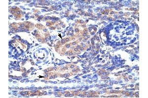 KCNAB3 antibody was used for immunohistochemistry at a concentration of 4-8 ug/ml to stain Epithelial cells of renal tubule (arrows) in Human Kidney.