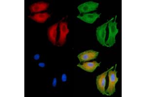 ABIN6260504 and ABIN6279263 staining  cells by IF/ICC. (CATSPER1 anticorps  (N-Term))