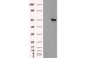 Image no. 5 for anti-Checkpoint Kinase 2 (CHEK2) antibody (ABIN1497498) (CHEK2 anticorps)