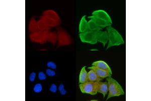 ABIN6257620 and ABIN6275306 staining Hela cells(30 min of UV treatment) by IF/ICC.