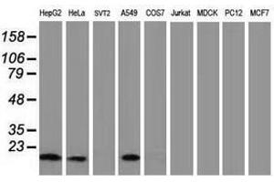 Image no. 6 for anti-Destrin (Actin Depolymerizing Factor) (DSTN) antibody (ABIN1497910) (Destrin anticorps)