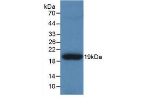 Western blot analysis of recombinant Human TNC. (TNC anticorps  (AA 49-181))