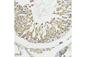 Immunohistochemistry of paraffin-embedded rat testis using H antibody (ABIN7267593) at dilution of 1:100 (40x lens). (HACE1 anticorps  (AA 1-100))