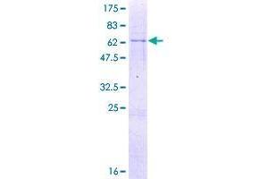 Image no. 1 for Myb/SANT-Like DNA-Binding Domain Containing 3 (MSANTD3) (AA 1-275) protein (GST tag) (ABIN1347710)