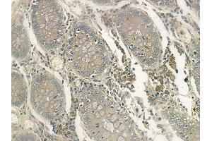 ABIN6263060 and ABIN6272509 at 1/100 staining human normal colon tissue by IHC-P. (MAGEA11 anticorps  (C-Term))