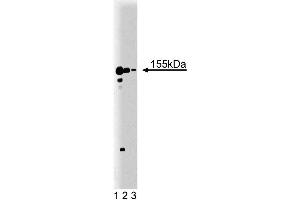 Western blot analysis of nNOS on a rat pituitary lysate. (NOS1 anticorps  (AA 1095-1289))