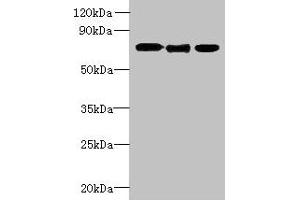 Western blot All lanes: SLC23A1 antibody at 3 μg/mL Lane 1: A549 whole cell lysate Lane 2: Mouse liver tissue Lane 3: Mouse kidney tissue Secondary Goat polyclonal to rabbit IgG at 1/10000 dilution Predicted band size: 65, 66, 29 kDa Observed band size: 65 kDa