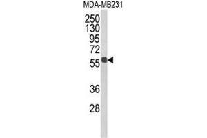 Western blot analysis of ALDH3B1 Antibody (Center) in MDA-MB231 cell line lysates (35ug/lane). (ALDH3B1 anticorps  (Middle Region))