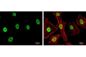 ICC/IF Image SAE1 antibody detects SAE1 protein at nucleus by immunofluorescent analysis. (SAE1 anticorps)