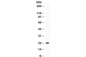 Western blot testing of human K562 cell lysate with G-CSF antibody. (G-CSF anticorps  (AA 38-207))