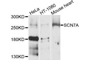 Western blot analysis of extracts of various cells, using SCN7A antibody.