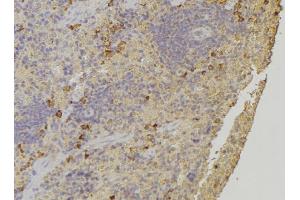 ABIN6272244 at 1/100 staining Human lymph node tissue by IHC-P. (ARHGAP1 anticorps  (Internal Region))