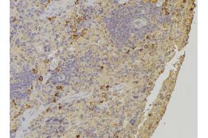 ABIN6272244 at 1/100 staining Human lymph node tissue by IHC-P.