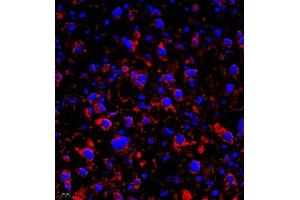 Immunofluorescence (IF) image for anti-Chloride Intracellular Channel 6 (CLIC6) antibody (ABIN7073478)