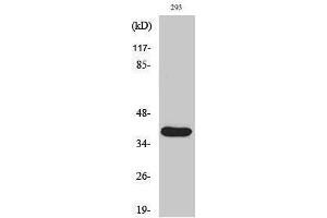 Western Blotting (WB) image for anti-Matrix Metallopeptidase 23 (MMP23) (cleaved), (Tyr79) antibody (ABIN3179353) (Matrix Metallopeptidase 23 (MMP23) (cleaved), (Tyr79) anticorps)