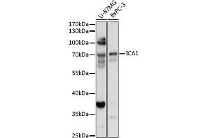 Western blot analysis of extracts of various cell lines, using IC antibody (7500) at 1:1000 dilution. (ICA1 anticorps  (AA 1-160))