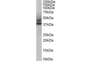 ABIN184954 staining (1ug/ml) of Human Skeletal Muscle lysate (RIPA buffer, 35ug total protein per lane). (TRIM54 anticorps  (C-Term))