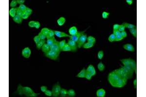 Immunofluorescence staining of PC-3 cells with ABIN7150389 at 1:133, counter-stained with DAPI.