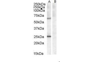 (ABIN238598) (0. (COL4A3BP anticorps  (AA 662-672))