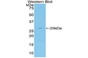 Western Blotting (WB) image for anti-Jagged 2 (JAG2) (AA 709-941) antibody (ABIN3202317) (JAG2 anticorps  (AA 709-941))