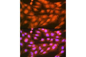 Immunofluorescence analysis of C6 cells using PSMD14 Rabbit mAb (ABIN7269588) at dilution of 1:100 (40x lens).