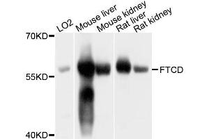 Western blot analysis of extracts of various cell lines, using FTCD antibody (ABIN5996118) at 1/1000 dilution. (FTCD anticorps)