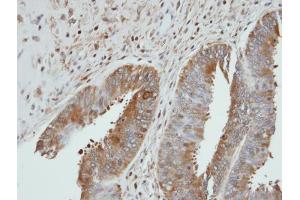 IHC-P Image Immunohistochemical analysis of paraffin-embedded UGP2 xenograft, using UGP2, antibody at 1:100 dilution.