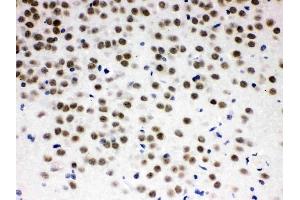 anti-Zinc Finger and BTB Domain Containing 7A (ZBTB7A) (AA 125-163), (N-Term) antibody