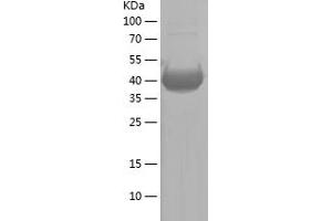 Western Blotting (WB) image for B-Raf proto-oncogene, serine/threonine kinase (BRAF) (AA 8-170) protein (His-IF2DI Tag) (ABIN7121967)