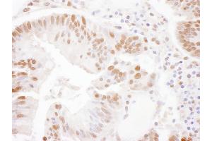 Immunohistochemistry (IHC) image for anti-Structure Specific Recognition Protein 1 (SSRP1) (AA 150-200) antibody (ABIN7453796)