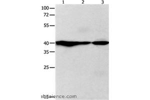 Western blot analysis of Human fetal brain and brain malignant glioma, mouse brain tissue, using GNAZ Polyclonal Antibody at dilution of 1:400