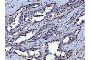 IHC analysis of KAP1 using anti-KAP1 antibody (ABIN3043491). (KAP1 anticorps  (AA 699-835))