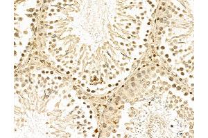 ABIN7094335 and ABIN7098382 at 1/100 staining Rat testis tissue by IHC-P. (LAS1L anticorps  (C-Term))