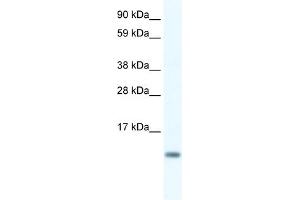 WB Suggested Anti-FXYD5 Antibody Titration:  0. (FXYD5 anticorps  (N-Term))
