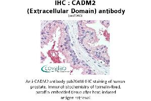 Image no. 1 for anti-Cell Adhesion Molecule 2 (CADM2) (Extracellular Domain) antibody (ABIN1732535) (CADM2 anticorps  (Extracellular Domain))