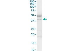 ADA MaxPab rabbit polyclonal antibody. (ADA anticorps  (AA 1-363))