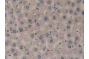 Detection of F13A1 in Rat Liver Tissue using Polyclonal Antibody to Coagulation Factor XIII A1 Polypeptide (F13A1)