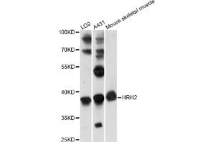 Western blot analysis of extracts of various cell lines, using HRH2 antibody (ABIN6290488) at 1:1000 dilution. (HRH2 anticorps)