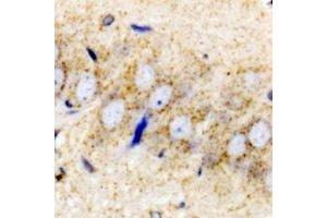 Immunohistochemistry (IHC) image for anti-Proenkephalin (PENK) antibody (ABIN7308156) (Enkephalin anticorps)