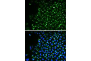 Immunofluorescence analysis of U2OS cells using PDHA1 antibody.