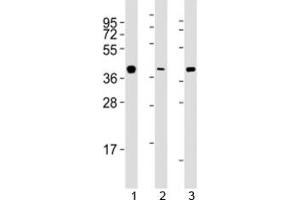 Western blot testing of ERCC1 antibody at 1:2000 dilution. (ERCC1 anticorps  (AA 268-297))