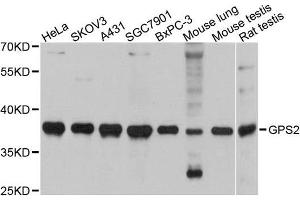 Western blot analysis of extracts of various cell lines, using GPS2 antibody. (GPS2 anticorps)