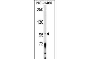 Western blot analysis of AK Antibody (Center) (ABIN652454 and ABIN2842308) in NCI- cell line lysates (35 μg/lane). (AKAP3 anticorps  (AA 240-267))