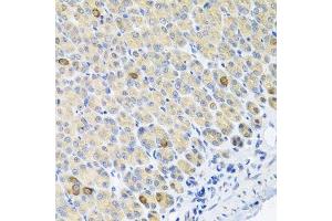 Immunohistochemistry of paraffin-embedded mouse stomach using GLS antibody. (Glutaminase anticorps  (AA 610-669))