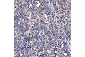 IHC analysis of TTC7B using anti-TTC7B antibody (ABIN7601050). (TTC7B anticorps  (AA 275-730))