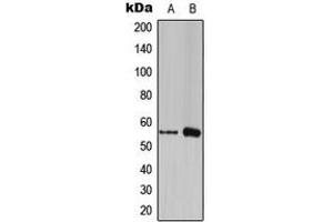 Western blot analysis of FOXC1/2 expression in THP1 (A), RAW264. (FOXC1 anticorps  (Center))