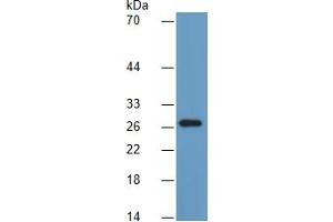 Mouse Capture antibody from the kit in WB with Positive Control: Human brain lysate.