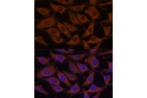 Immunofluorescence analysis of L929 cells using CREB3 antibody (ABIN6128862, ABIN6139013, ABIN6139015 and ABIN6222241) at dilution of 1:100.
